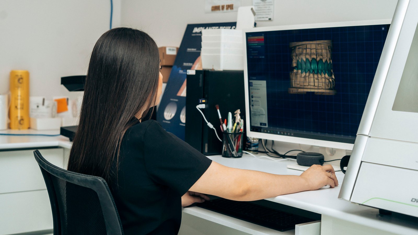 modelado-3d-dental-tepic